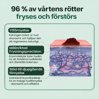 Nordfyn™ HudKlar™ ChillErase – Precisionskylande spray för slätare hud